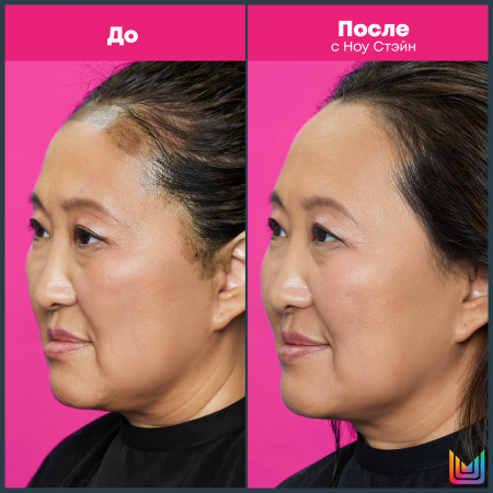 Matrix ср-во удаления красителя с кожи головы 237 мл NO STAIN {12} - фото