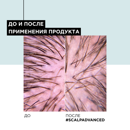 LP смываемый уход 200 мл Анти-Дискомф {6} - фото